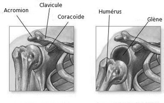 luxation image1